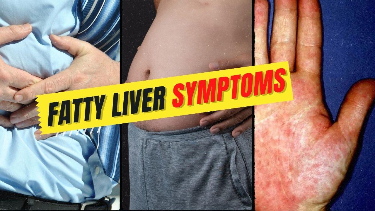 fatty-liver-symptoms-do-you-have-nafld-fatty-liver-treatment-diet