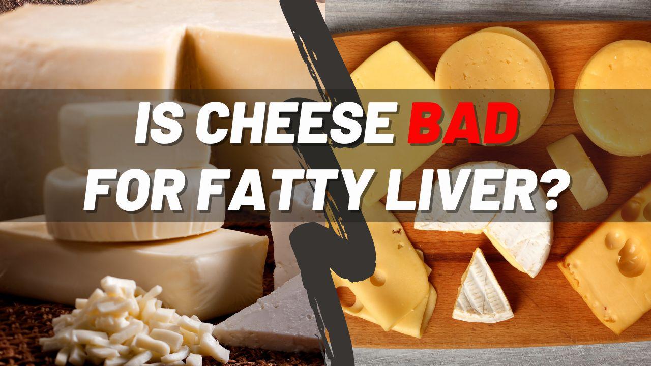 Is Cheese Bad For Fatty Liver Fatty Liver Treatment Diet